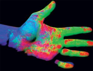 Catching psoriasis red-handed (Image: Christye Sisson/Rochester Institute of Technology)