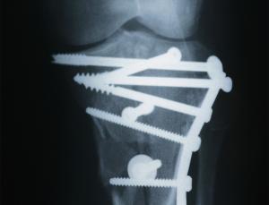 Ditch the ironmongery (Image: Corbis)